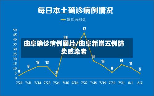 曲阜确诊病例图片/曲阜新增五例肺炎感染者