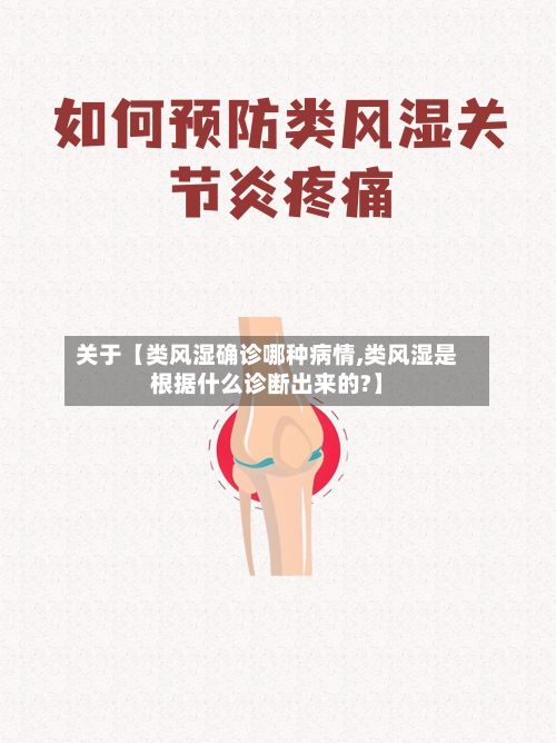 关于【类风湿确诊哪种病情,类风湿是根据什么诊断出来的?】