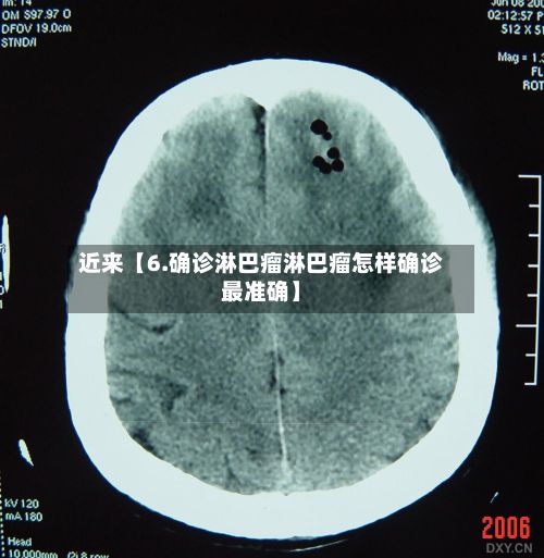 近来【6.确诊淋巴瘤淋巴瘤怎样确诊最准确】-第2张图片