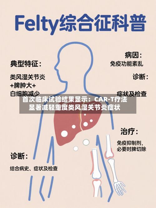 首次临床试验结果显示：CAR-T疗法显著减轻重度类风湿关节炎症状